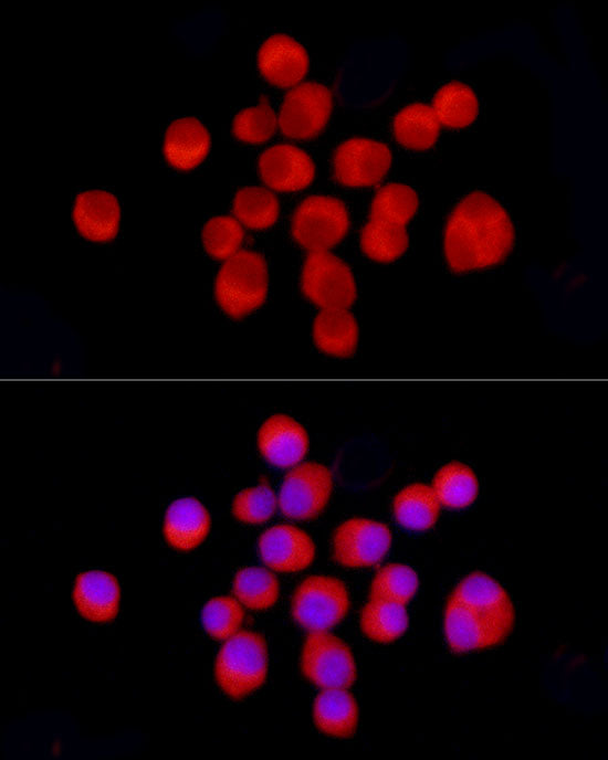 Tyrosine Hydroxylase Rabbit pAb