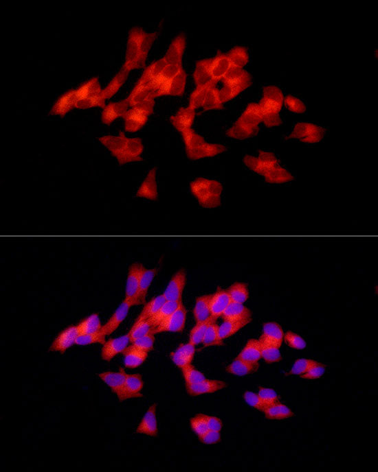 Tyrosine Hydroxylase Rabbit pAb