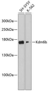 Kdm6b Rabbit pAb