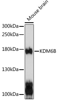 Kdm6b Rabbit pAb