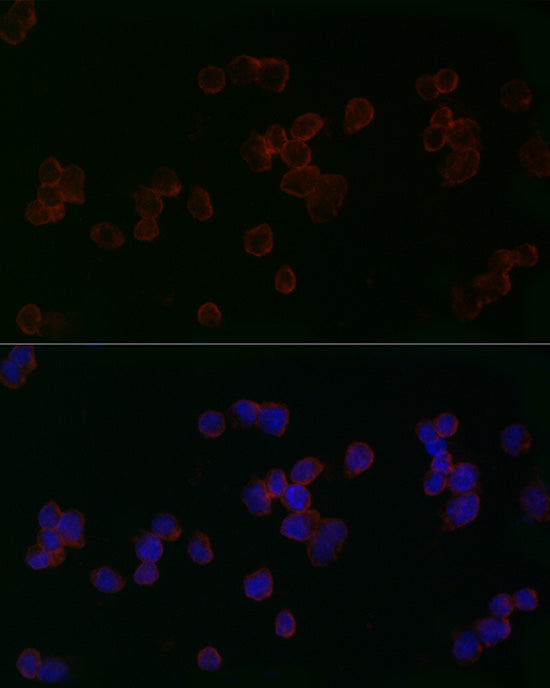 Mitofusin 2 Rabbit pAb