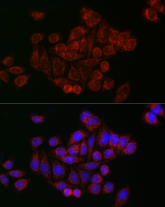 Mitofusin 2 Rabbit pAb