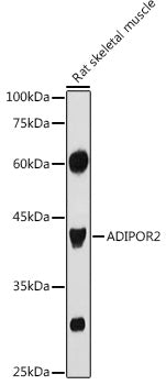 ADIPOR2 Rabbit pAb