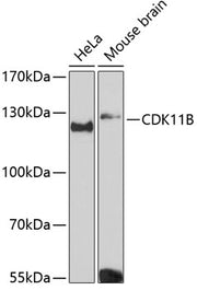 CDK11B Rabbit pAb