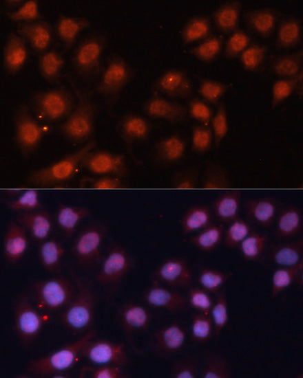 CDK11B Rabbit pAb