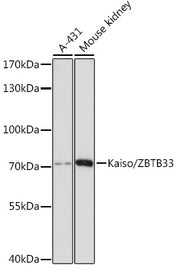 Kaiso/ZBTB33 Rabbit pAb