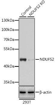 [KO Validated] NDUFS2 Rabbit pAb