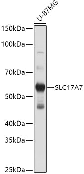 SLC17A7 Rabbit pAb
