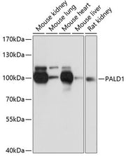 PALD1 Rabbit pAb