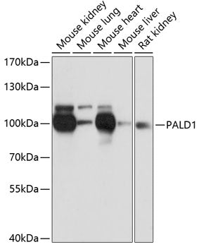 PALD1 Rabbit pAb