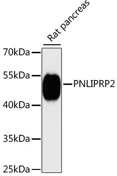 PNLIPRP2 Rabbit pAb