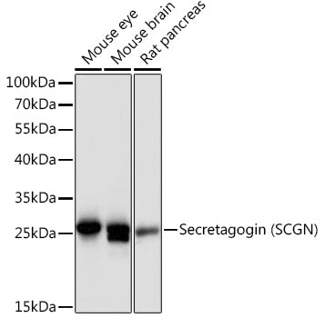 Secretagogin (SCGN) Rabbit pAb