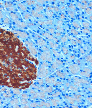 Secretagogin (SCGN) Rabbit pAb