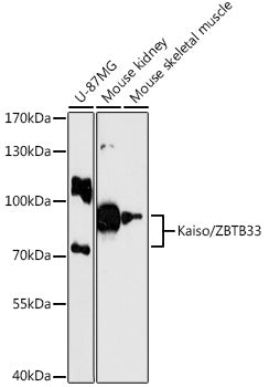 Kaiso/ZBTB33 Rabbit pAb