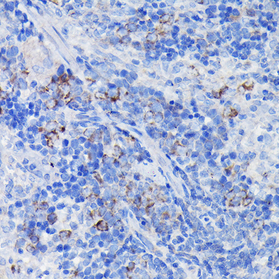 Clusterin alpha chain Rabbit pAb