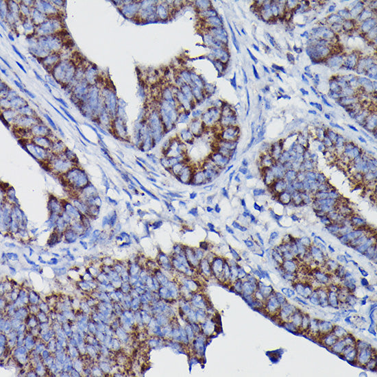 Clusterin alpha chain Rabbit pAb