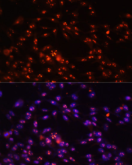 DKC1 Rabbit pAb