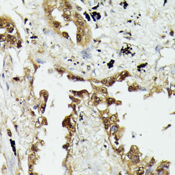 HSP70 Rabbit pAb