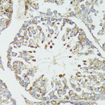 HSP70 Rabbit pAb