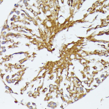 HSP70 Rabbit pAb