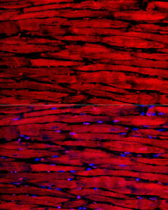 MYH6/α-MHC Rabbit pAb