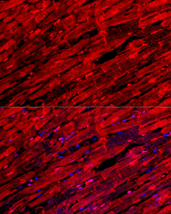 MYH6/α-MHC Rabbit pAb