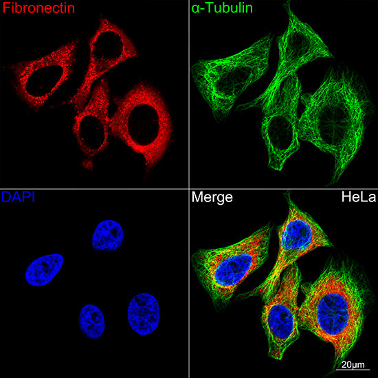 Fibronectin Rabbit mAb