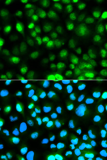 Ataxin-3 (ATXN3) Rabbit pAb