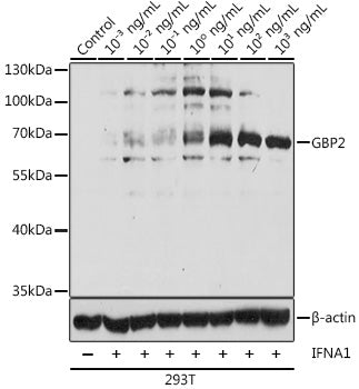 GBP2 Rabbit pAb