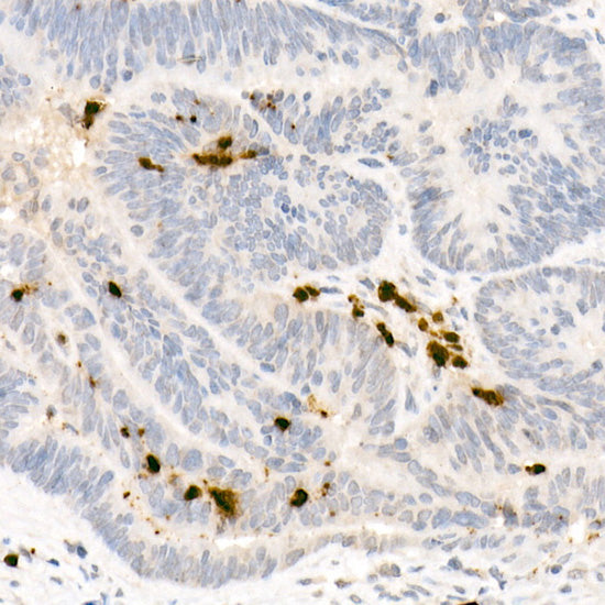 Neutrophil Elastase (ELANE) Rabbit pAb