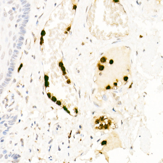 Neutrophil Elastase (ELANE) Rabbit pAb