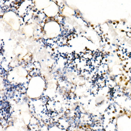 Neutrophil Elastase (ELANE) Rabbit pAb