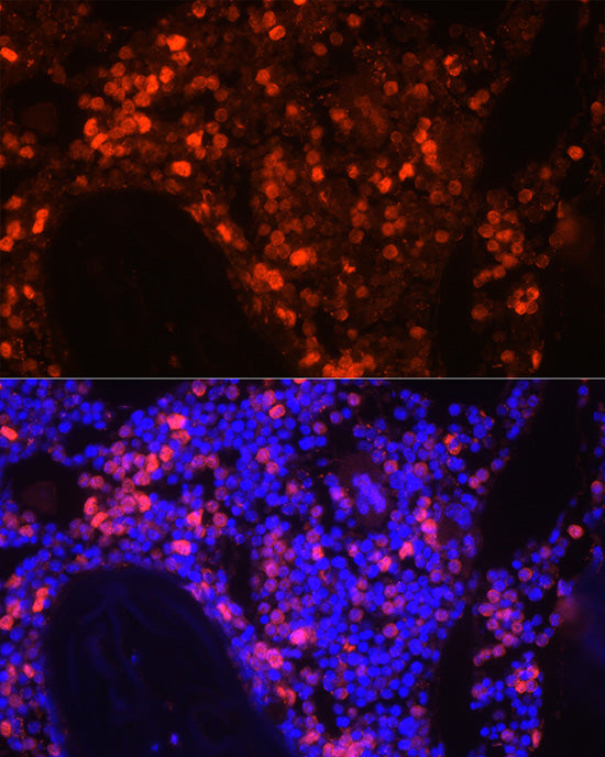 Neutrophil Elastase (ELANE) Rabbit pAb