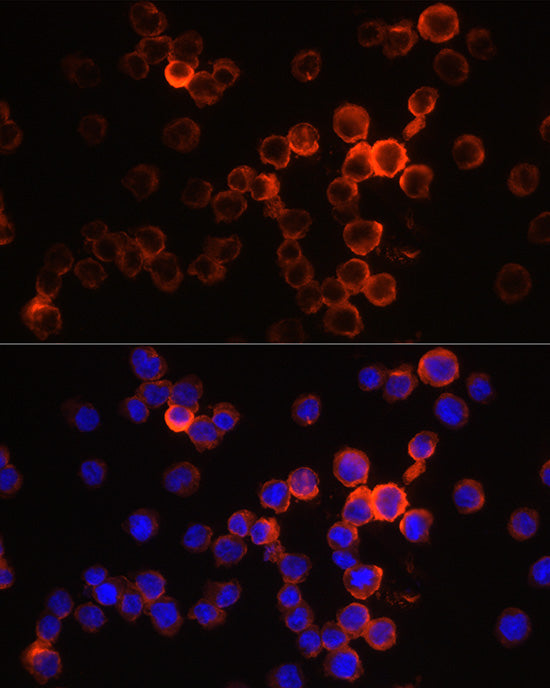 Neutrophil Elastase (ELANE) Rabbit pAb