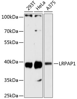 LRPAP1 Rabbit pAb