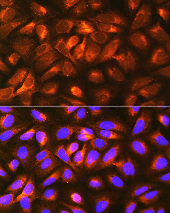 LRPAP1 Rabbit pAb