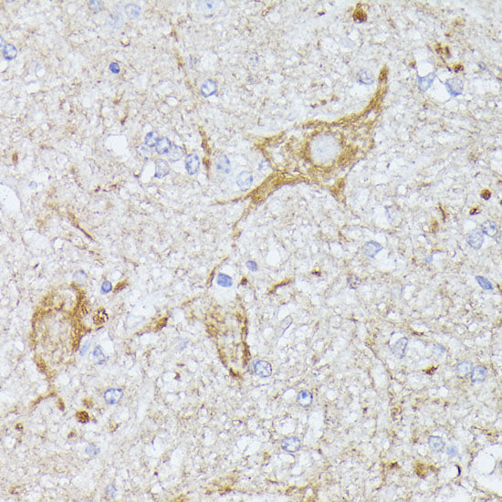 TBCA Rabbit pAb