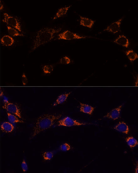Peroxiredoxin 3 (PRDX3) Rabbit pAb