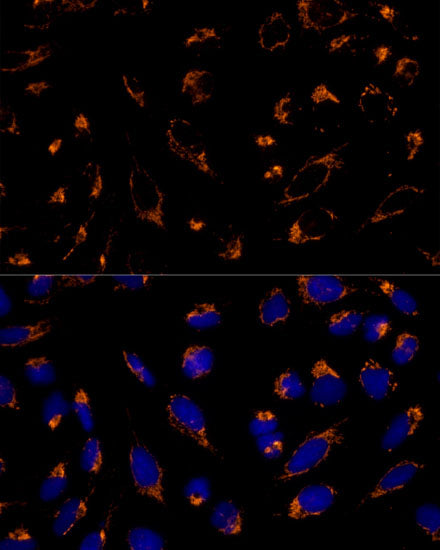 Peroxiredoxin 3 (PRDX3) Rabbit pAb