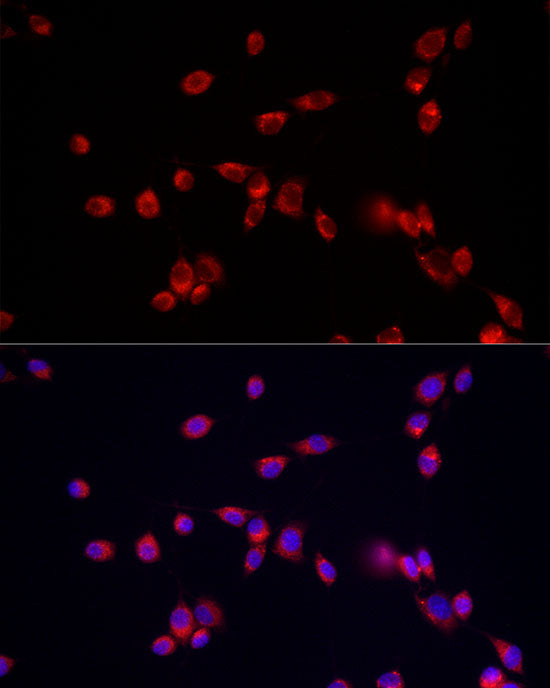 ATP13A2 Rabbit pAb
