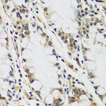 CASC5 Rabbit pAb