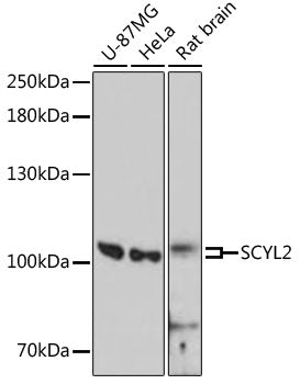 SCYL2 Rabbit pAb