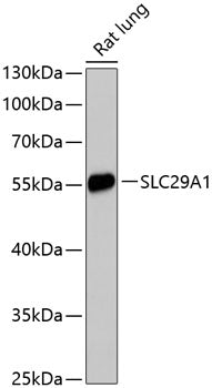 SLC29A1 Rabbit pAb