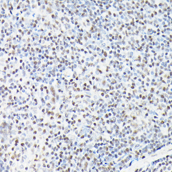 CTCF Rabbit pAb