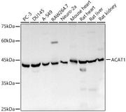 ACAT1 Rabbit pAb