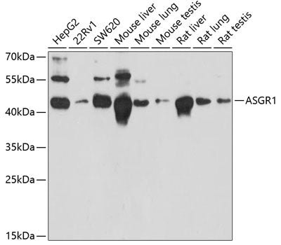 ASGR1 Rabbit pAb