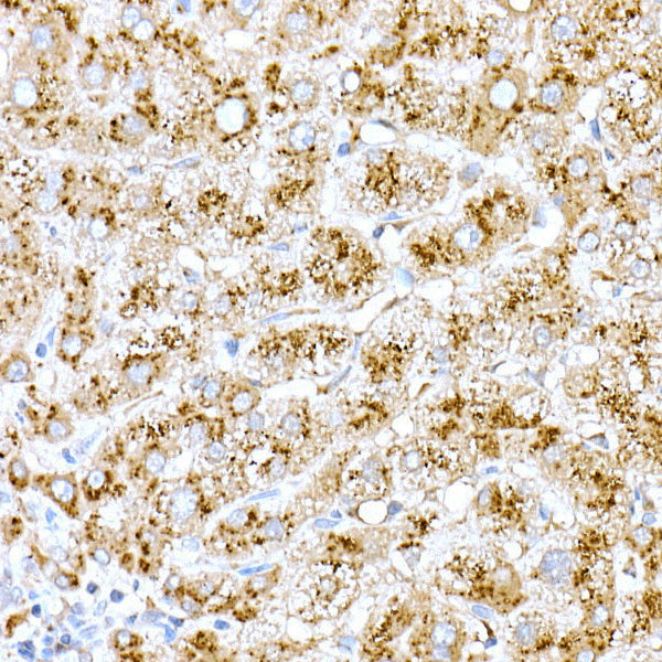 Cathepsin D Rabbit pAb