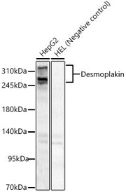 Desmoplakin Rabbit pAb