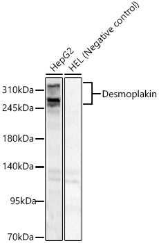 Desmoplakin Rabbit pAb