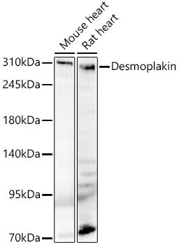 Desmoplakin Rabbit pAb